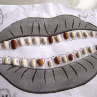 diş sağlığı